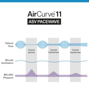 AirCurve-11-algorithm-ASV-PaceWave