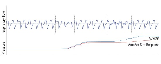 airsense-autoset-soft-response-algorithm-resmed-1
