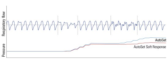 airsense-autoset-soft-response-algorithm-resmed-1