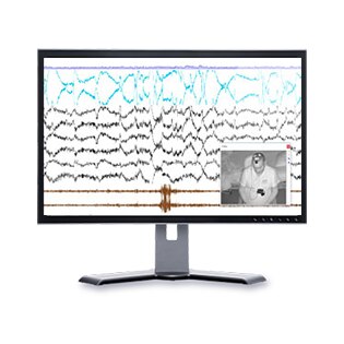 noxturnal-software-optagelse-video-resmed