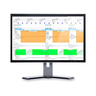 noxturnal-software-signal-ark-resmed